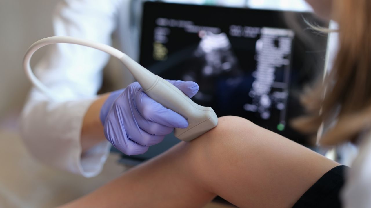 Ultrasound as a diagnostic tool in movement therapy