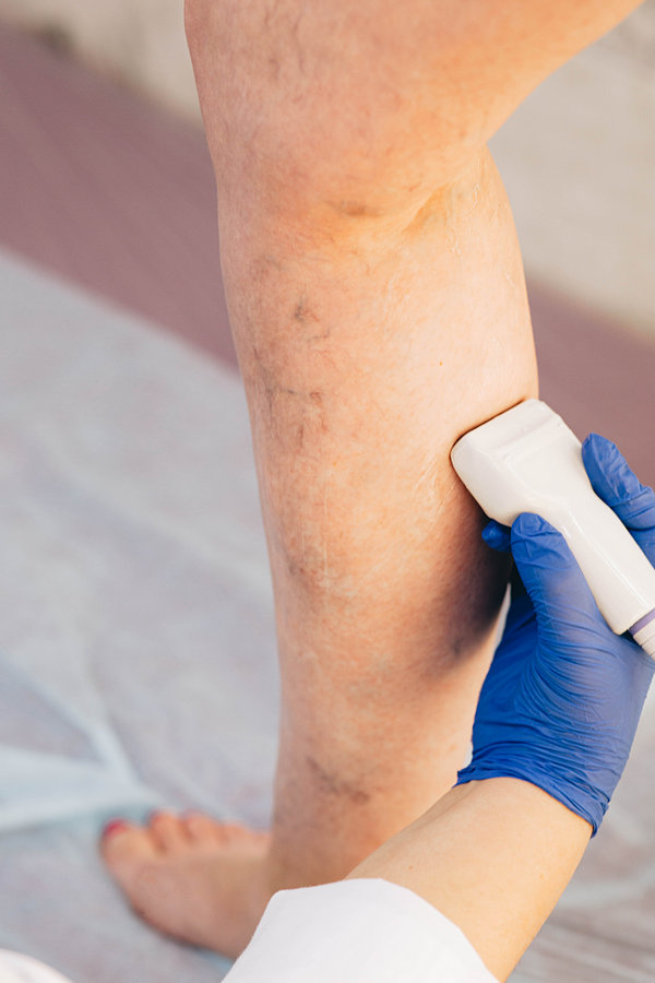 phlebologist warsaw carelife clinic